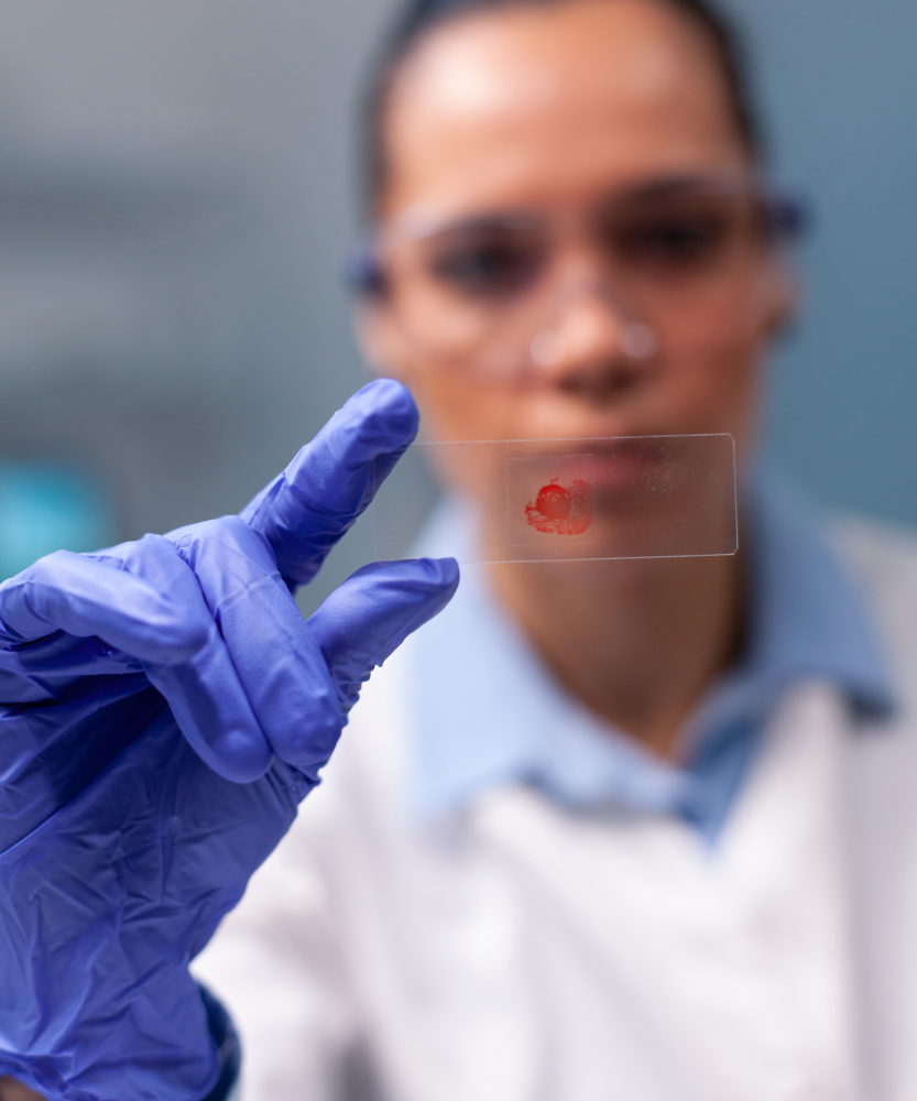 Biópsia para anatomopatológico na Presecor