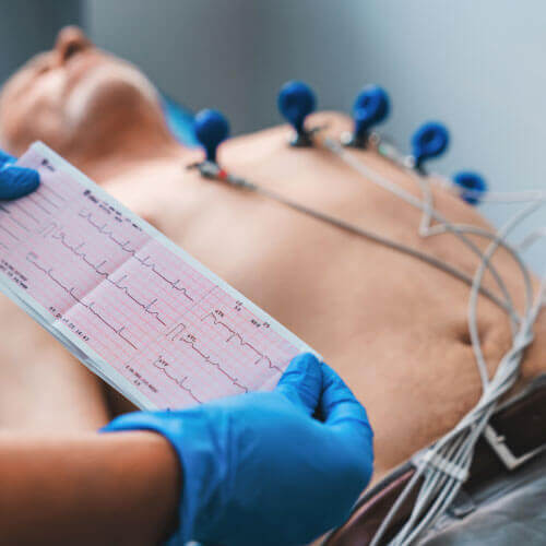 Ecocardiograma transtorácico na Presecor