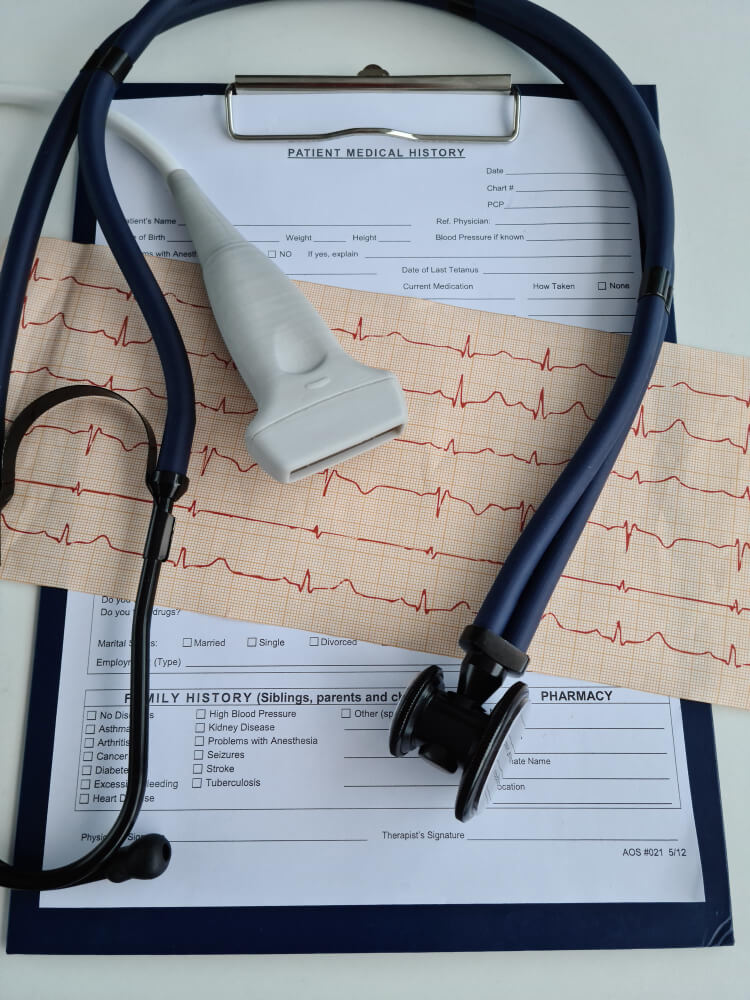 Ecocardiograma transtorácico na Presecor